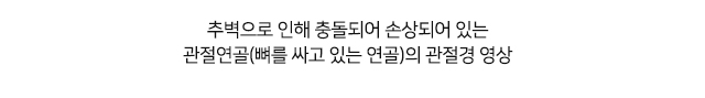 팔꿈치 증상별 진단