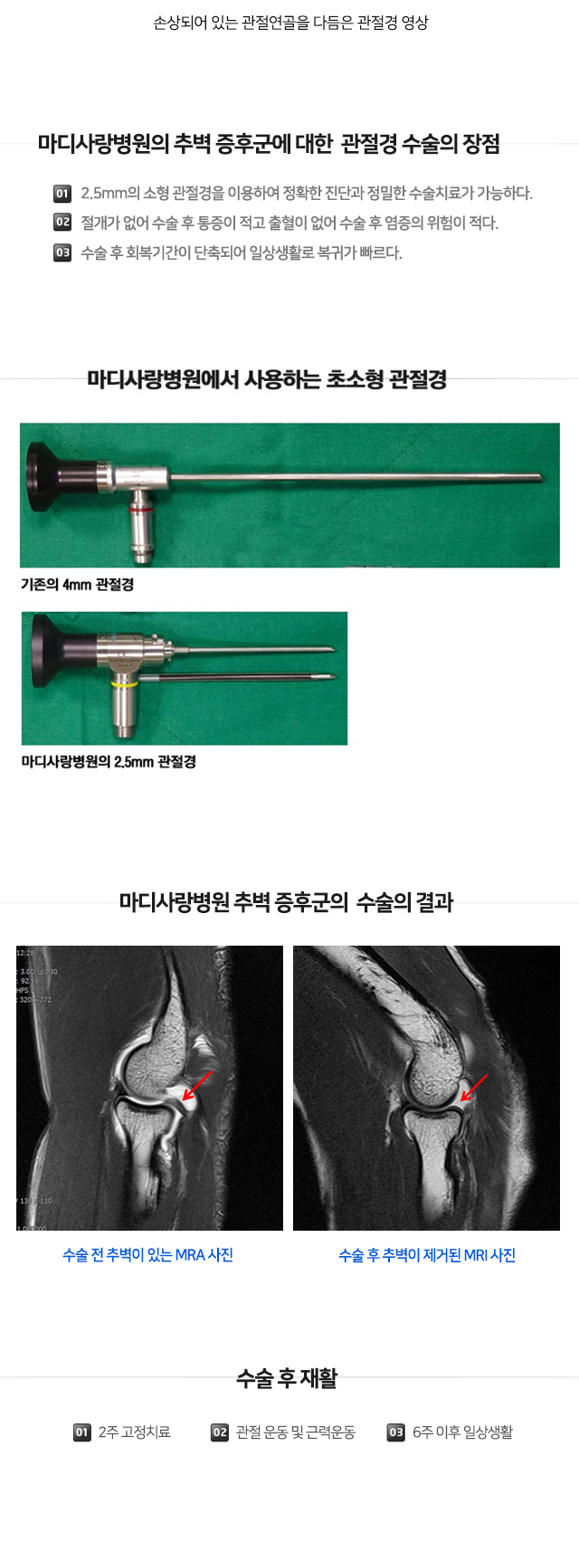 팔꿈치 증상별 진단
