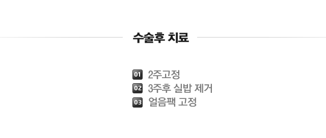 방아쇠 수지