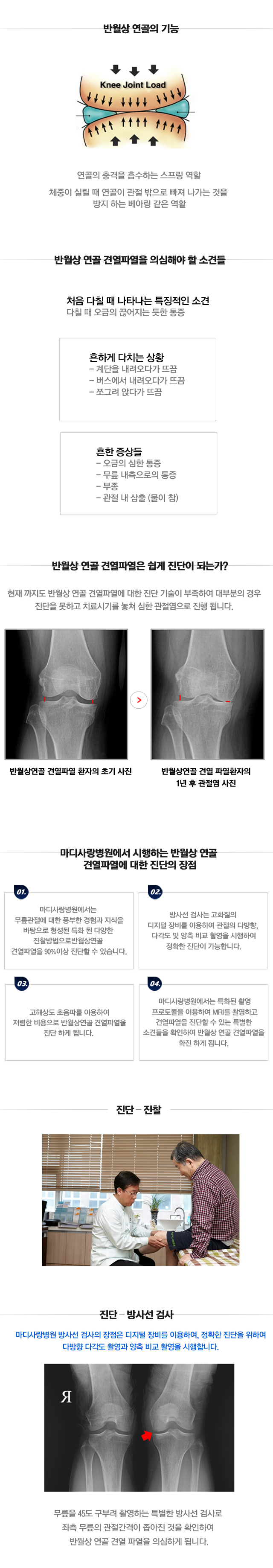 반월상연골 건열파열