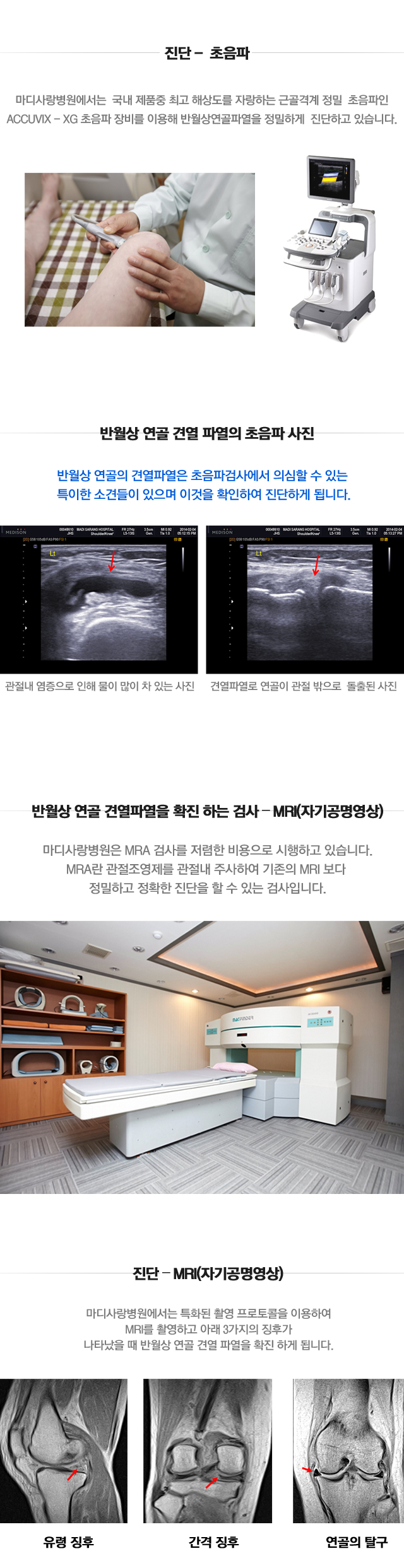 반월상연골 건열파열