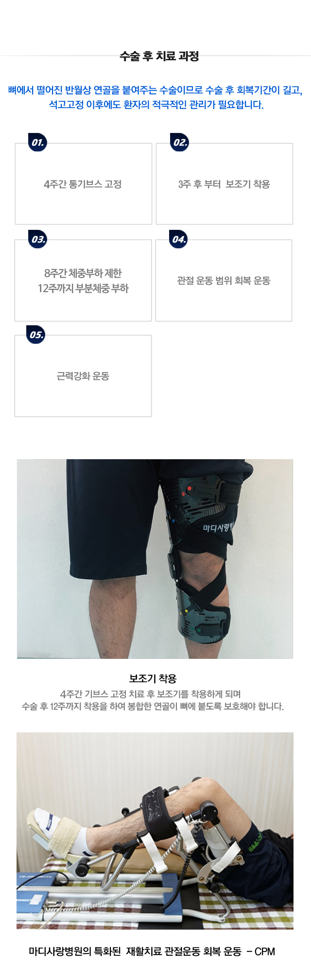 반월상연골 건열파열