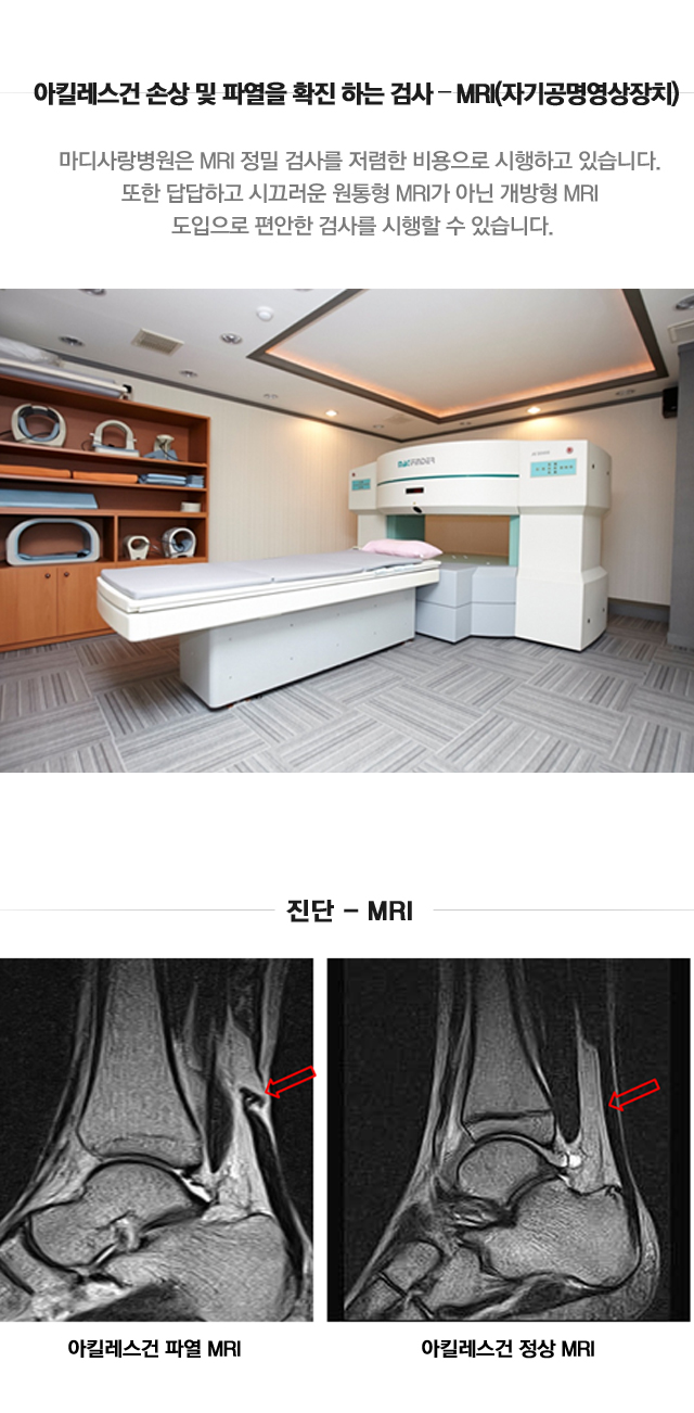 아킬레스건 손상 및 파열
