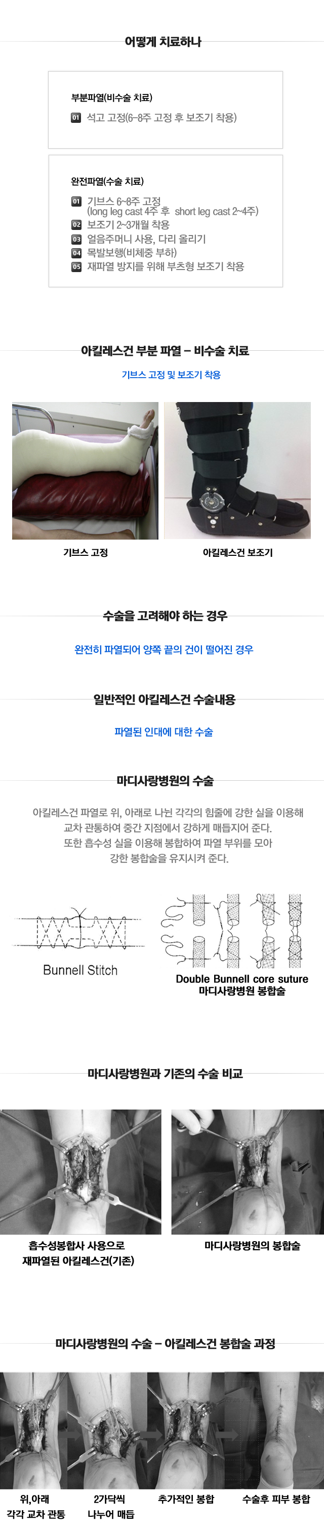 아킬레스건 손상 및 파열