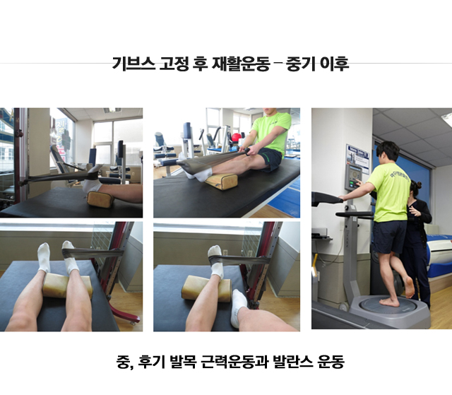 아킬레스건 손상 및 파열