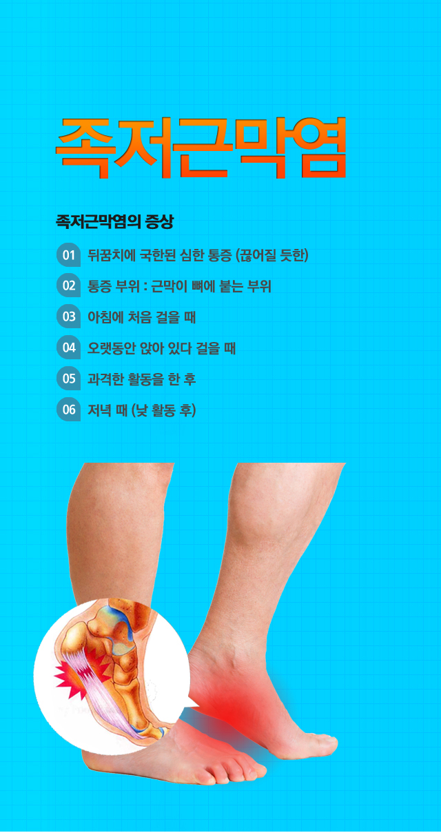 족저근막염