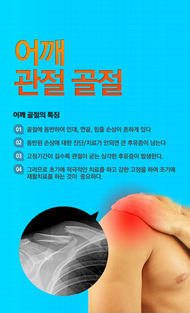 관절주위골절(어깨)