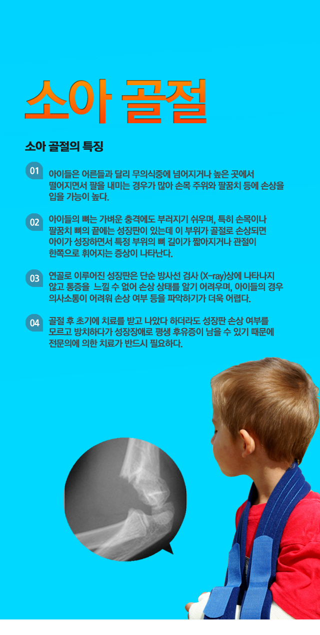 소아 골절
