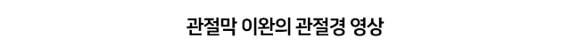 불안정성