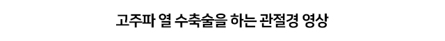 불안정성