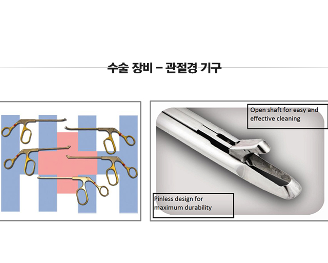 관절경 수술