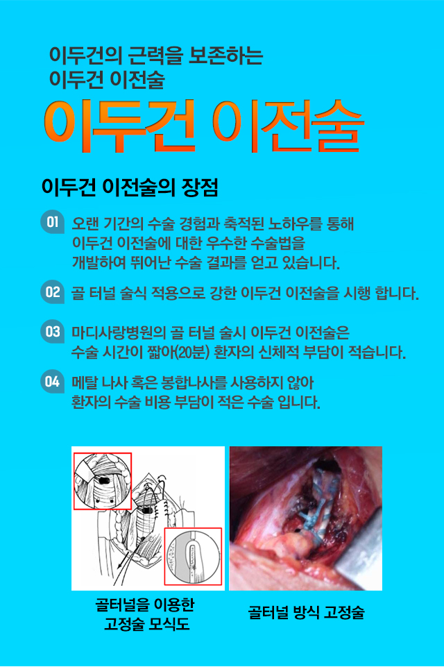 이두건 이전술
