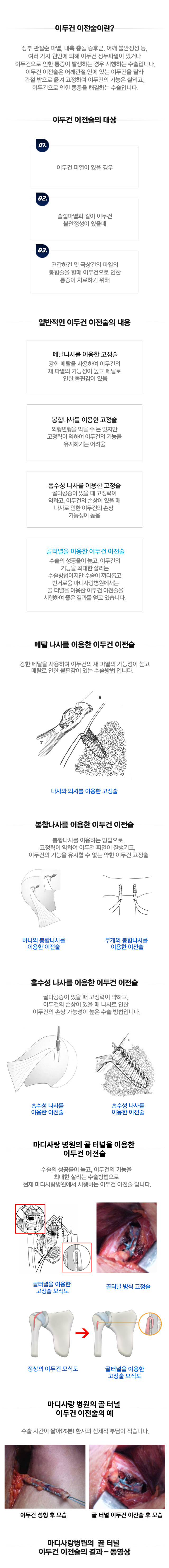 이두건 이전술