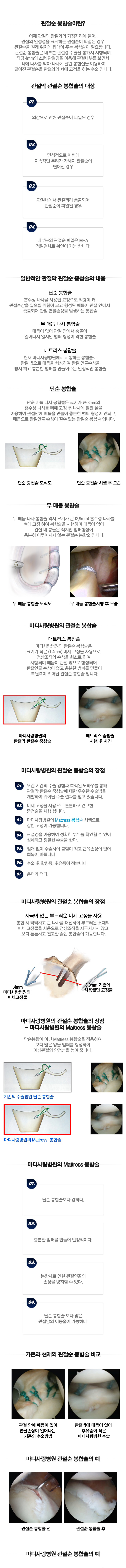 관절순 봉합술