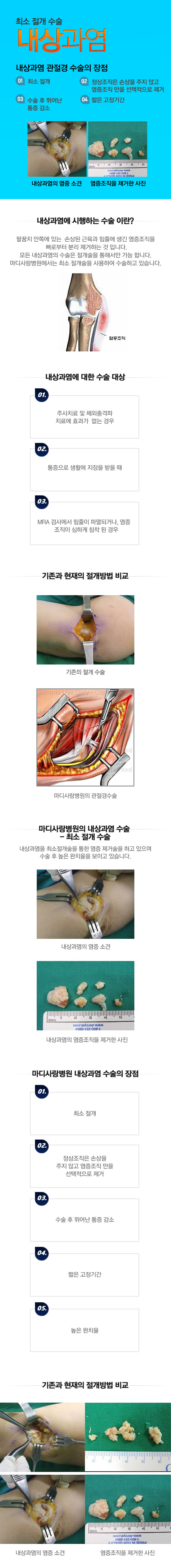 내상과염