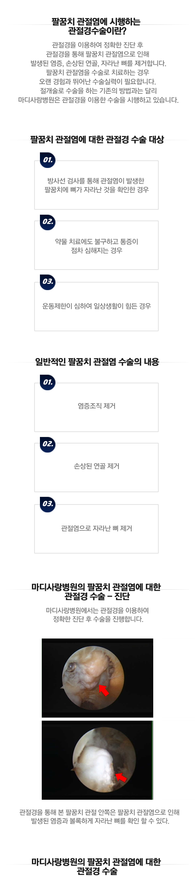 팔꿈치 관절염