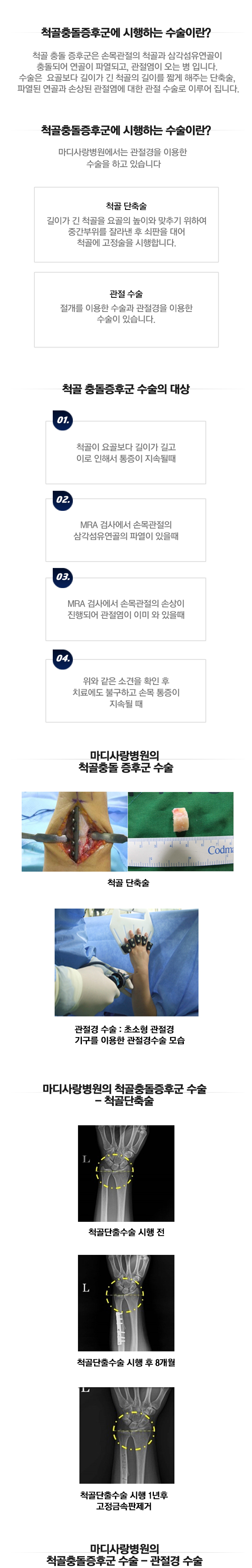 척골 충돌 증후군