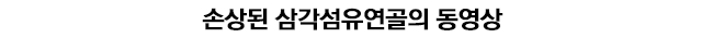 척골 충돌 증후군