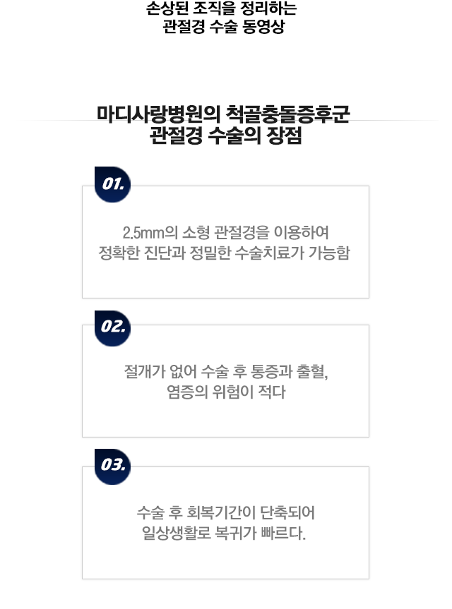 척골 충돌 증후군
