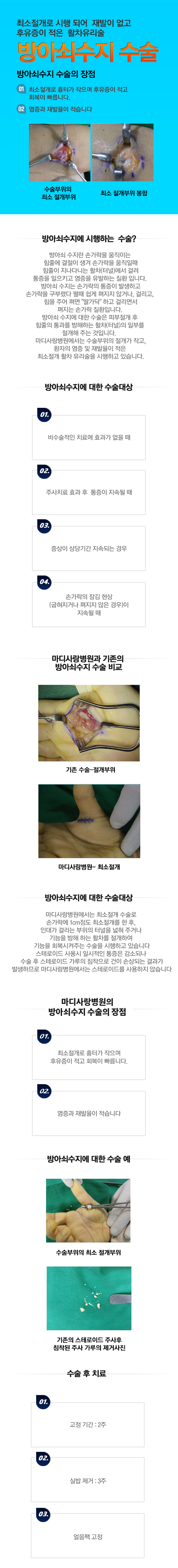 방아쇠 수지
