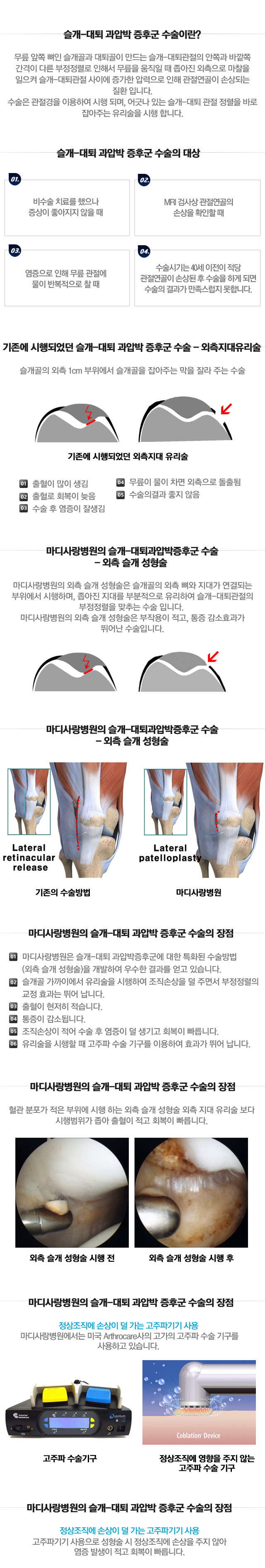 반월상연골 부분절제술