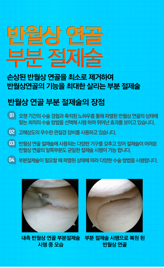 반월상연골 봉합술
