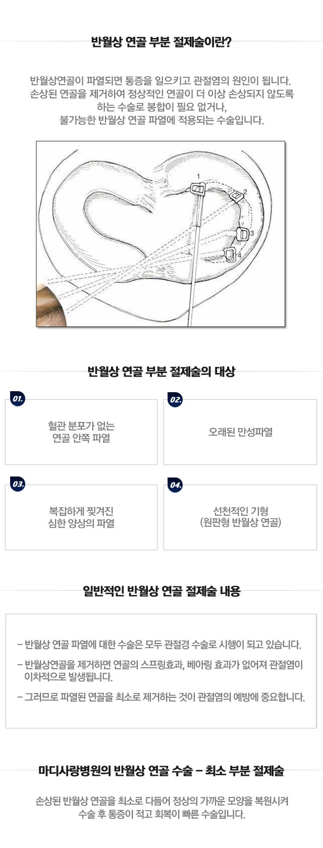 반월상연골 봉합술