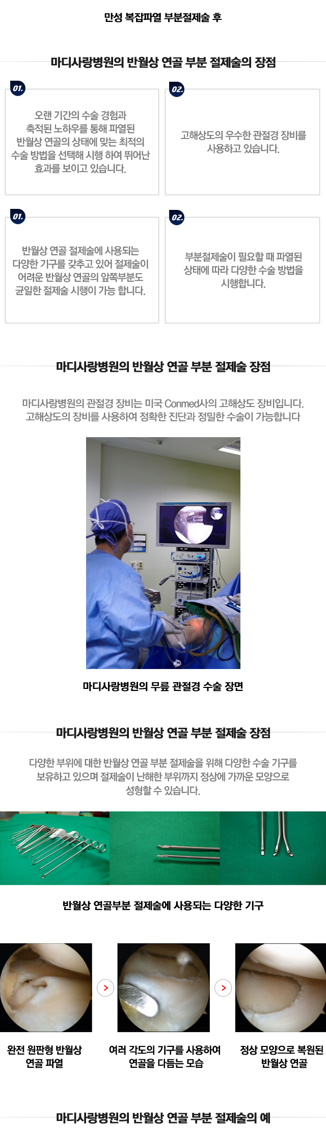 반월상연골 봉합술