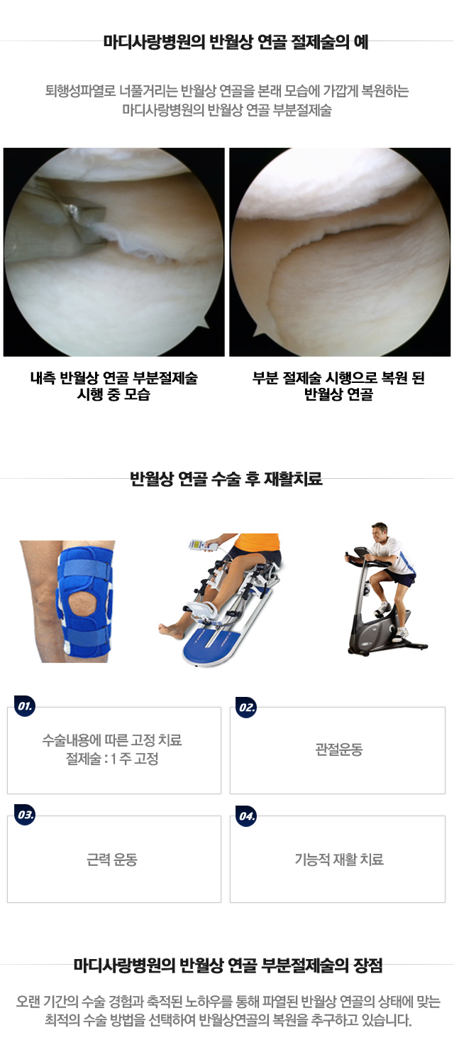 반월상연골 봉합술