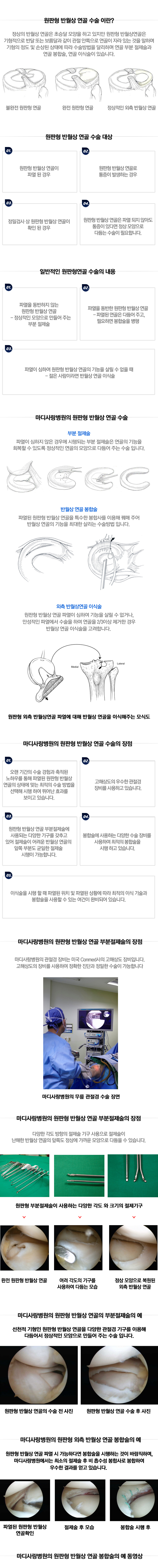 전방십자인대 재건술