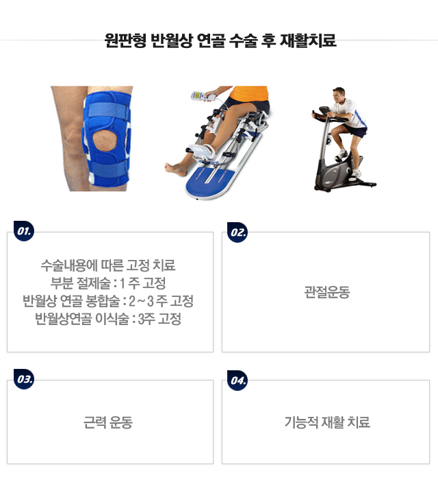 전방십자인대 재건술