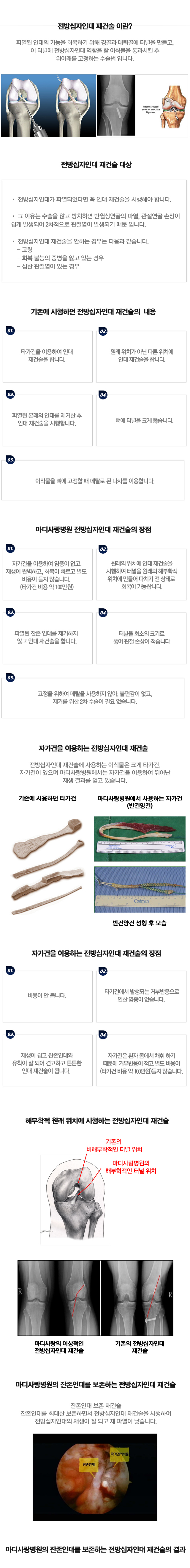 후방십자인대 재건술