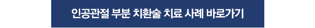 인공관절 전 치환술