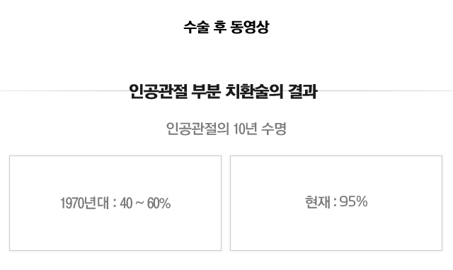 인공관절 전 치환술