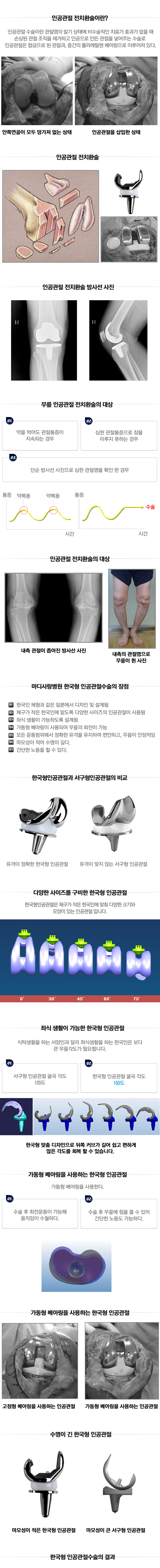 슬개대퇴관절 과압박 증후군