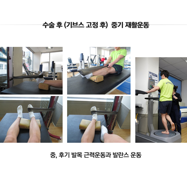 아킬레스건파열 및 손상 수술