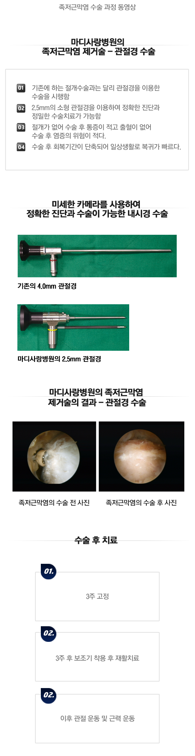 족저근막염