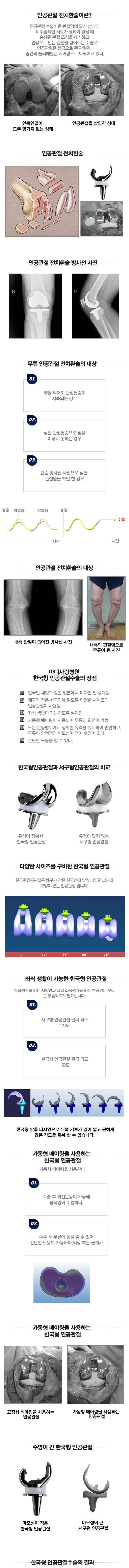무릎 인공관절 전치환술