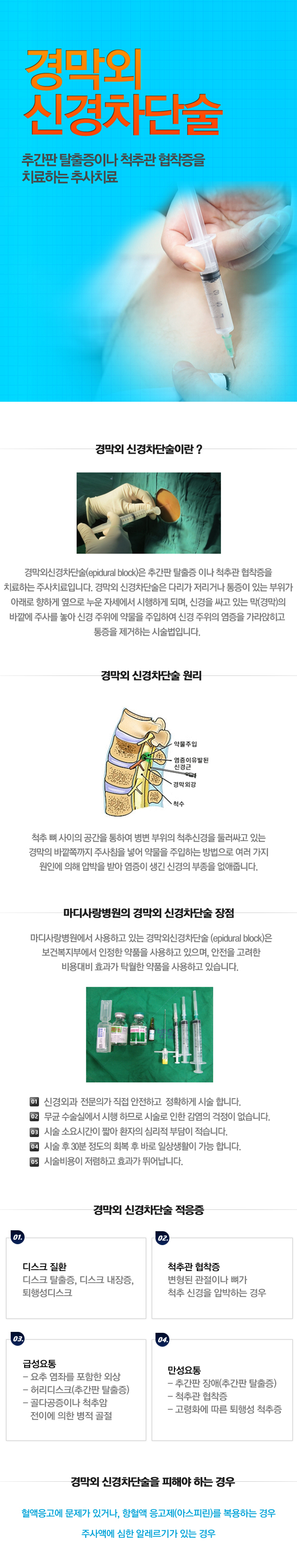 경막외 신경차단술