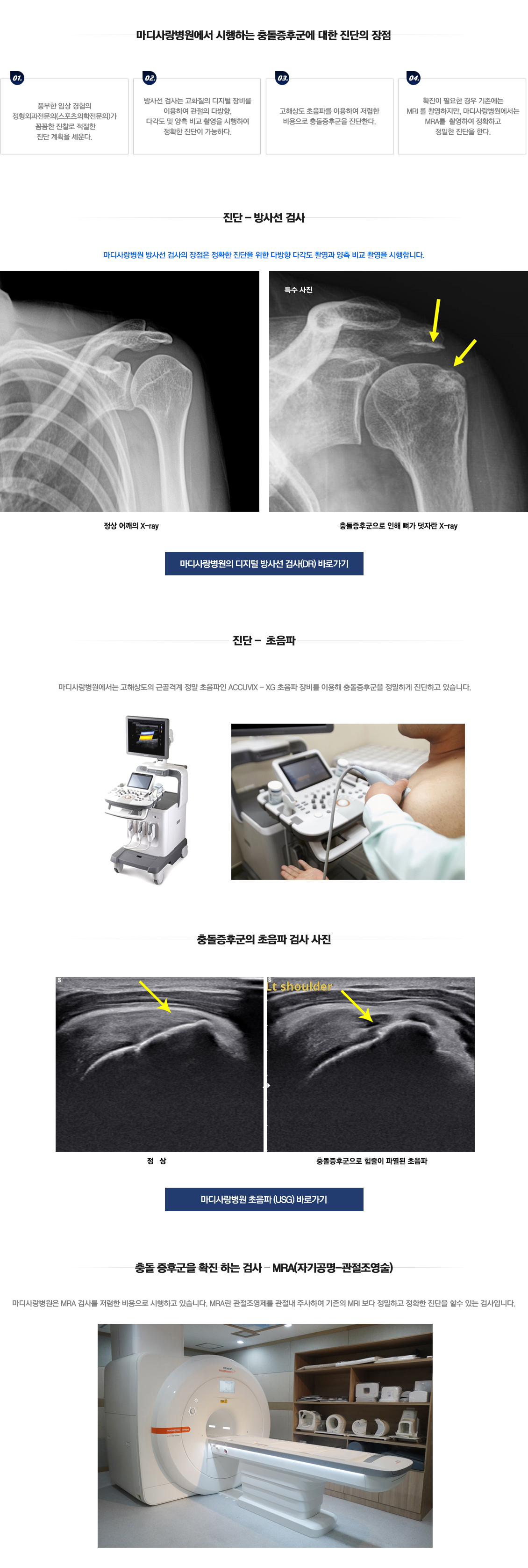 충돌증후군