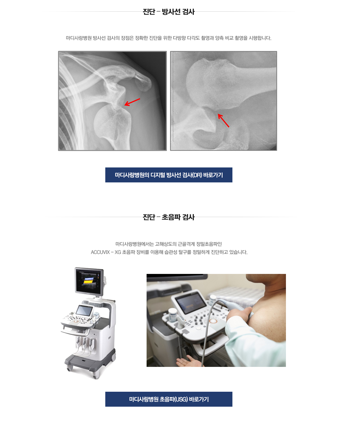 습관성 탈구