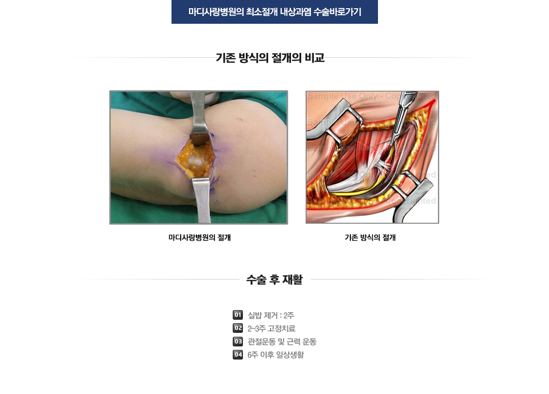 팔꿈치 증상별 진단 