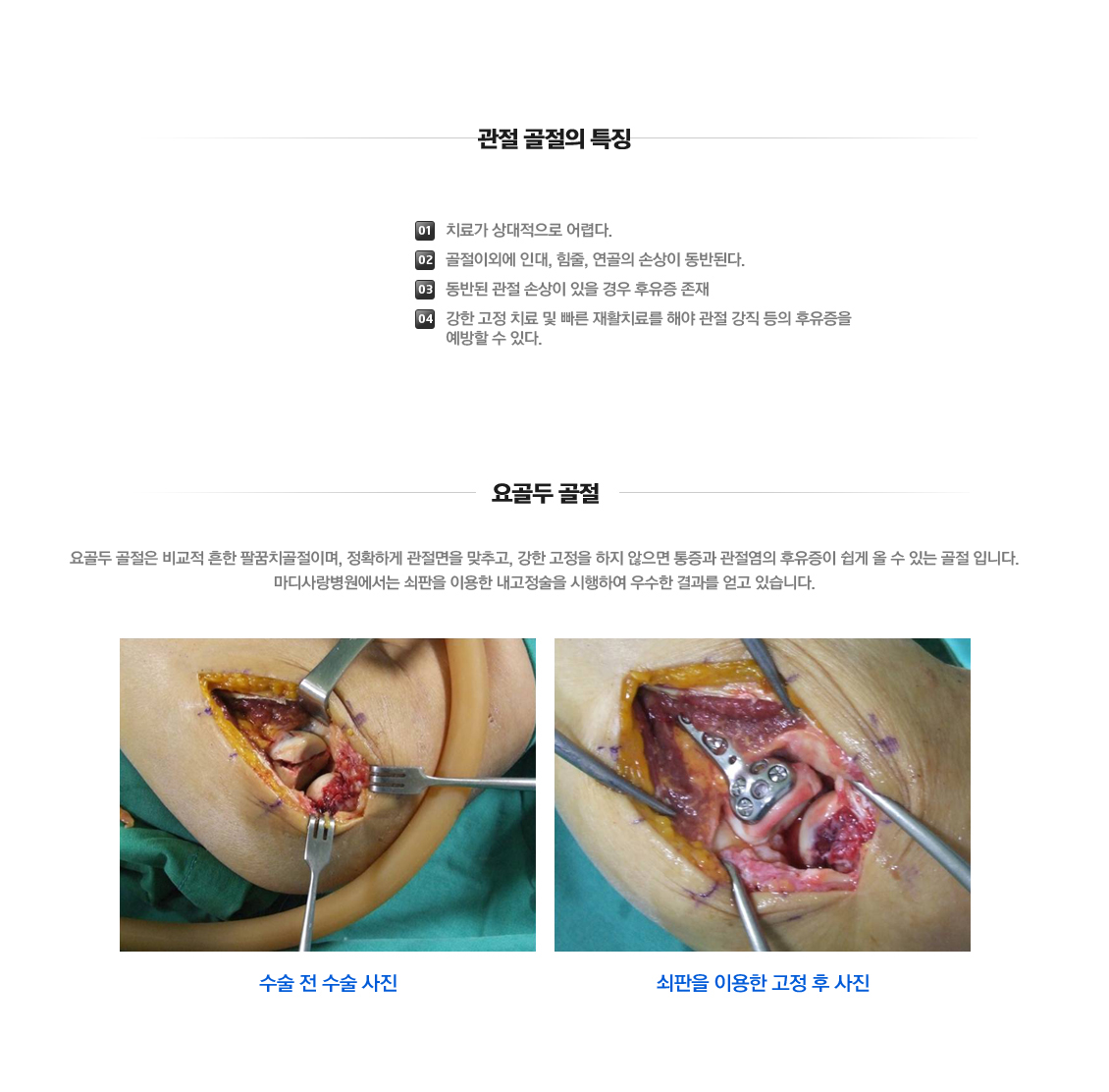 팔꿈치 증상별 진단 