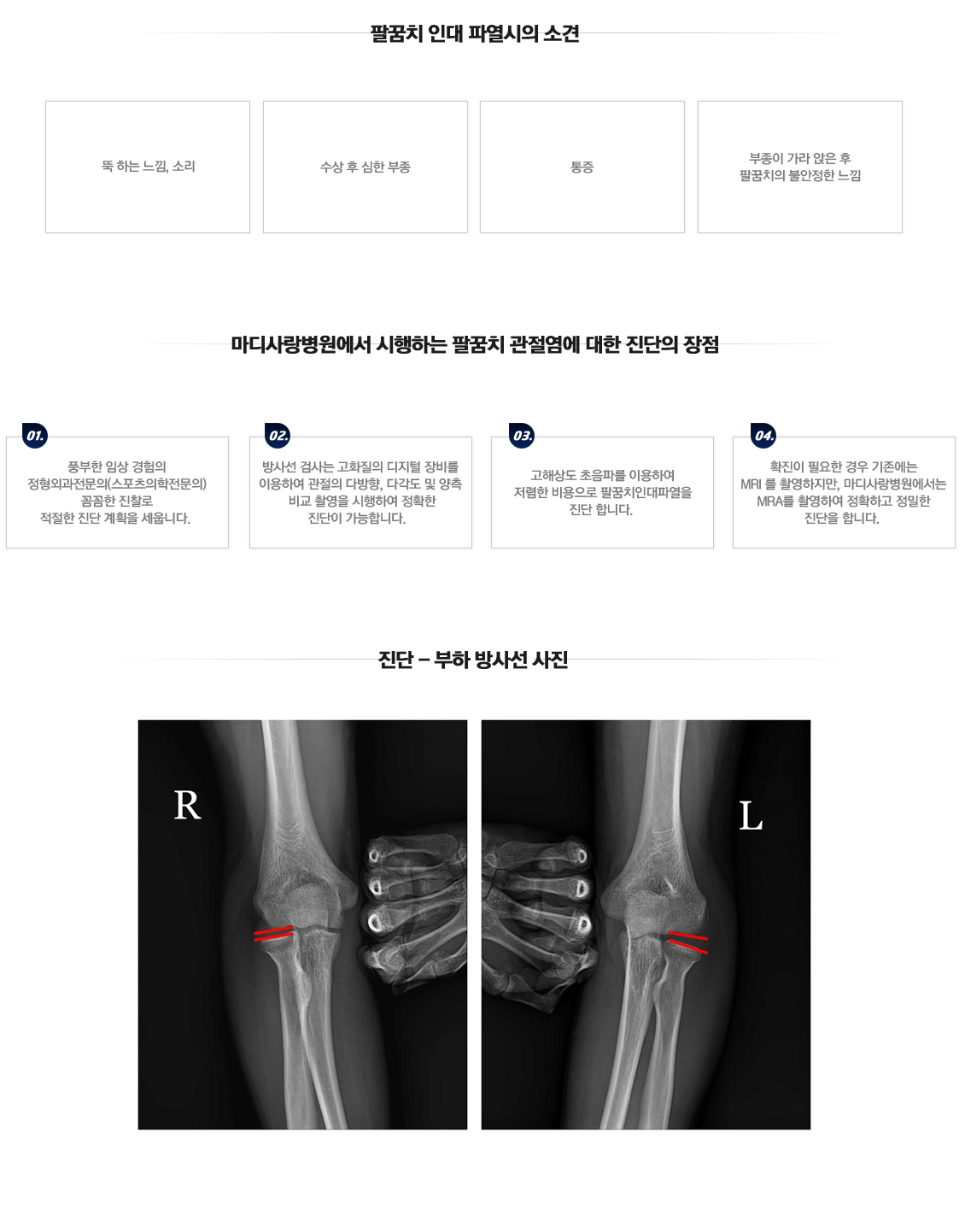 팔꿈치 증상별 진단 