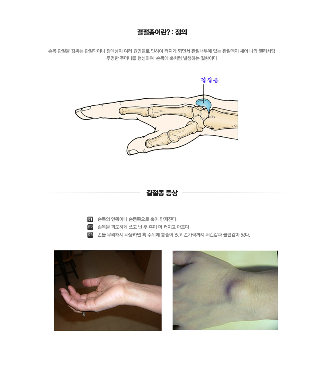 손목 증상별 진단 