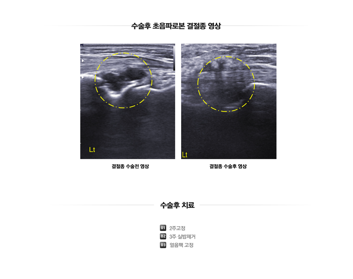 손목 증상별 진단 