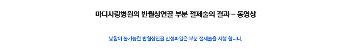 반월상연골파열