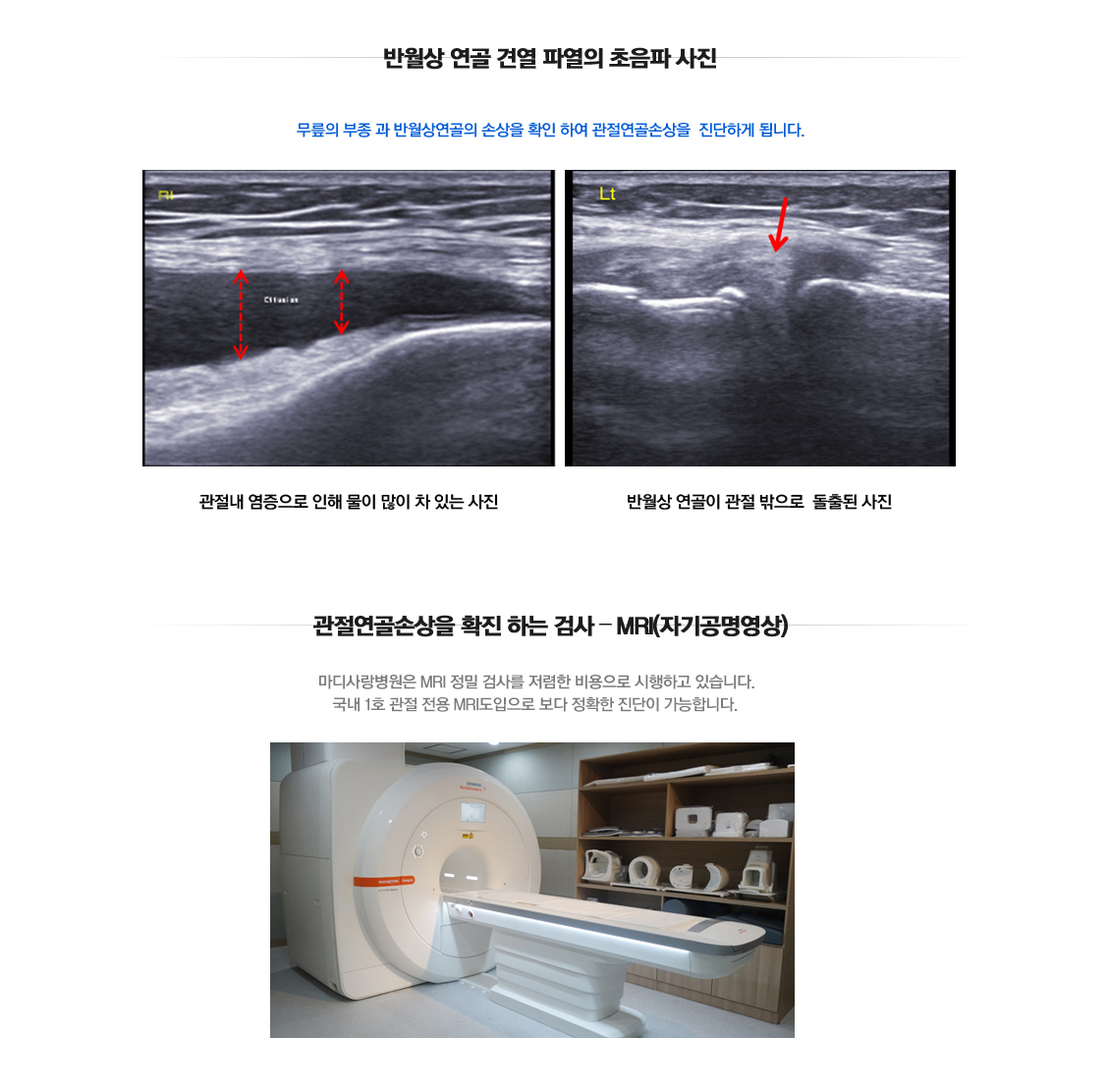 퇴행성관절염