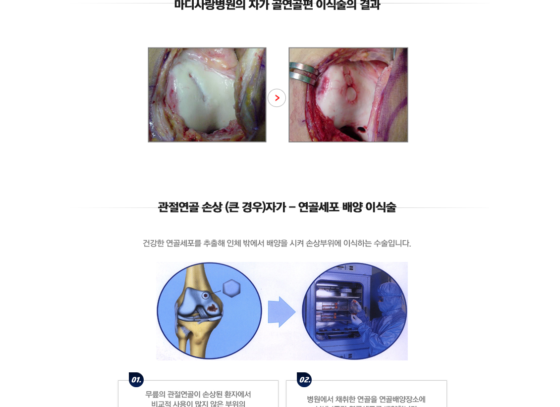 퇴행성관절염