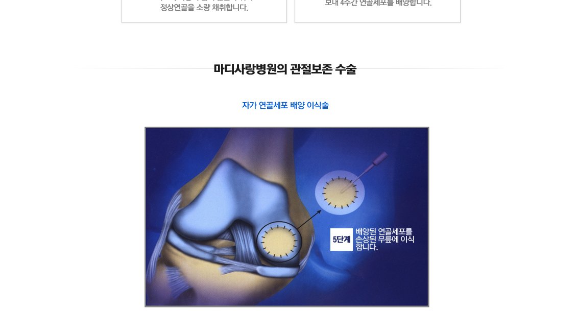 퇴행성관절염